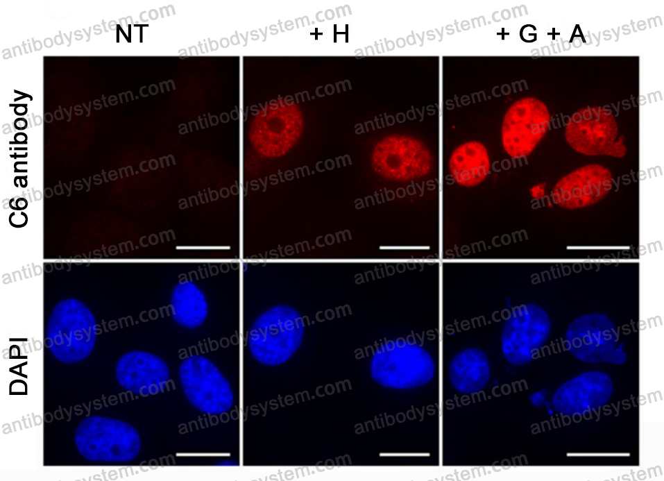 Immunofluorescence for Anti-Phospho-γ-H2AX (pS139) Antibody (C6) ?>